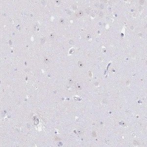 Anti-NOP14 antibody produced in rabbit 
