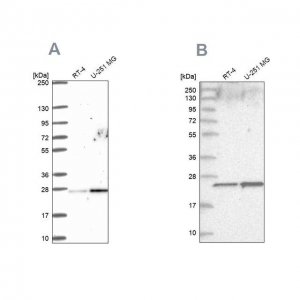 Anti-NOP16 antibody produced in rabbit 