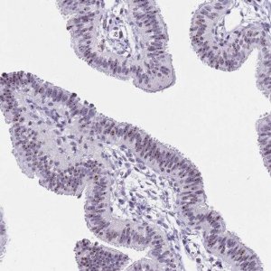 Anti-NOP56 antibody produced in rabbit HPA049918-100UL