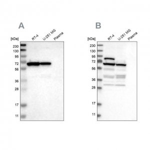 Anti-NOP58 antibody produced in rabbit 
