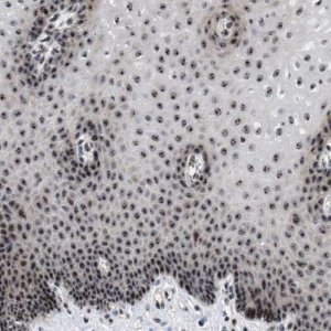 Anti-NOP58 antibody produced in rabbit 