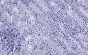 Anti-NOTCH2 Antibody, clone 1B14-5 ZooMAb Rabbit Monoclonal 
