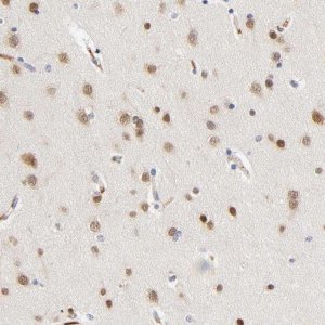 Anti-NOVA1 antibody produced in rabbit 