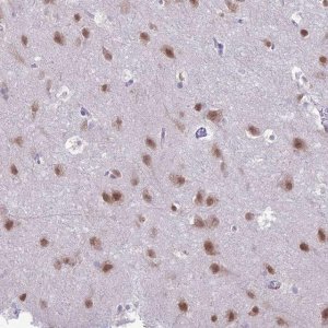 Anti-NOVA2 antibody produced in rabbit 
