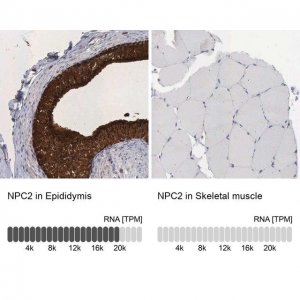 Anti-NPC2 antibody produced in rabbit 