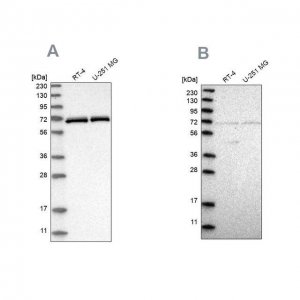 Anti-NPLOC4 antibody produced in rabbit 