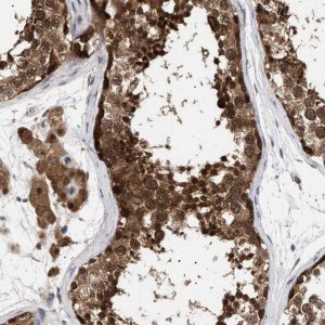 Anti-NPLOC4 antibody produced in rabbit 