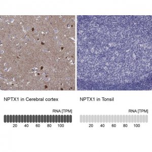 Anti-NPTX1 