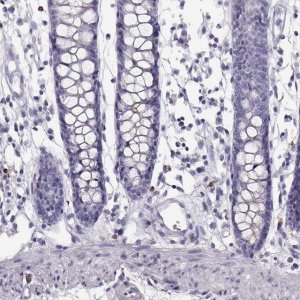 ANTI-NPTXR antibody produced in rabbit 