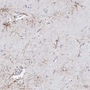 Anti-NR2E1 antibody produced in rabbit 