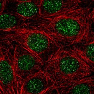 Anti-NR4A1 antibody produced in rabbit HPA059742-100UL