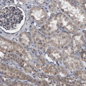 Anti-NRBP1 antibody produced in rabbit HPA029527-100UL