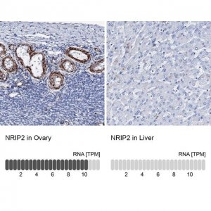 Anti-NRIP2 antibody produced in rabbit 