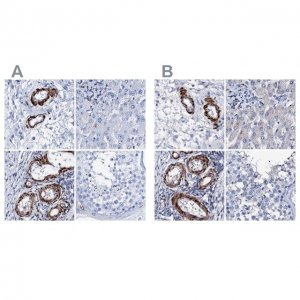 Anti-NRIP2 antibody produced in rabbit 