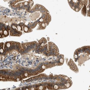 Anti-NRSN2 antibody produced in rabbit HPA015967-100UL