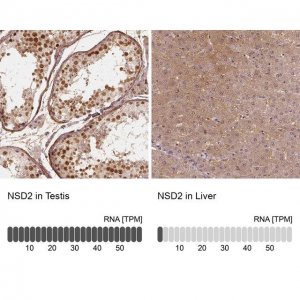 Anti-NSD2 antibody produced in rabbit 