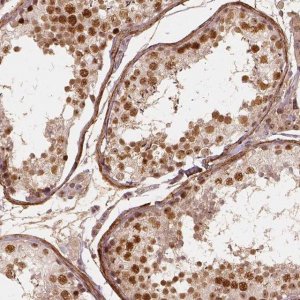 Anti-NSD2 antibody produced in rabbit 