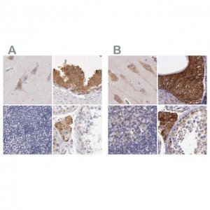 Anti-NSDHL antibody produced in rabbit 