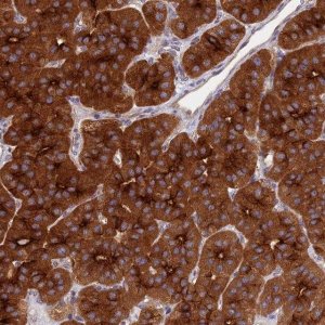 Anti-NSMCE1 antibody produced in rabbit 