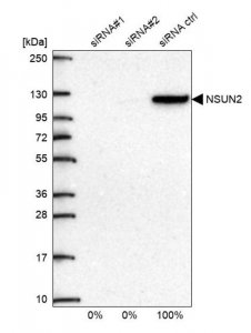 Anti-NSUN2 antibody produced in rabbit 