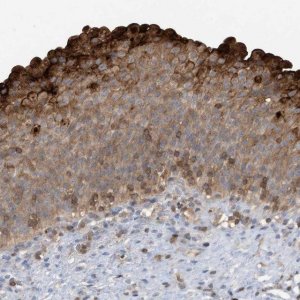 Anti-NSUN3 antibody produced in rabbit 