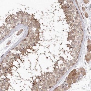 Anti-NSUN4 antibody produced in rabbit HPA028489-100UL