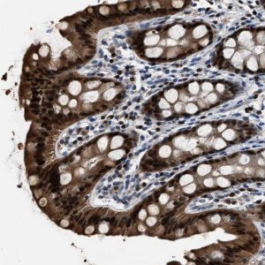 Anti-NSUN5 antibody produced in rabbit 