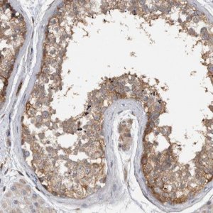 Anti-NT5C2 antibody produced in rabbit HPA003751-100UL