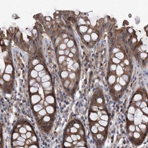 Anti-NT5C3A antibody produced in rabbit 