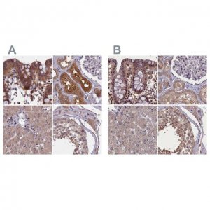 Anti-NUBP1 antibody produced in rabbit 