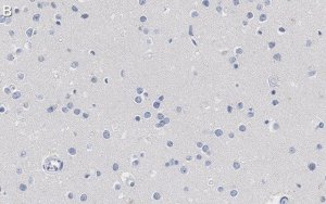 Anti-Nuclei Antibody, clone 3E1.3 ZooMAb Mouse Monoclonal 
