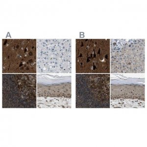 Anti-NUDCD3 antibody produced in rabbit 