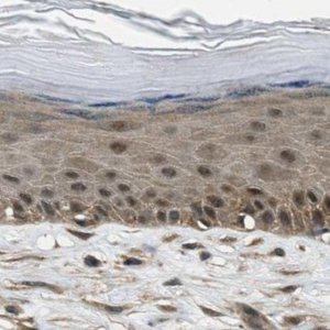 Anti-NUDCD3 antibody produced in rabbit 