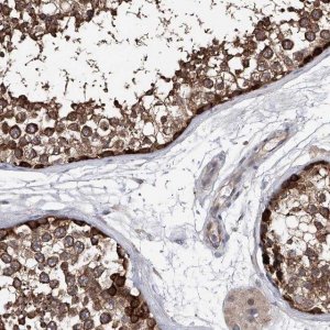 Anti-NUDT17 antibody produced in rabbit 