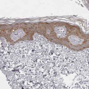 Anti-NUDT18 antibody produced in rabbit HPA028581-100UL