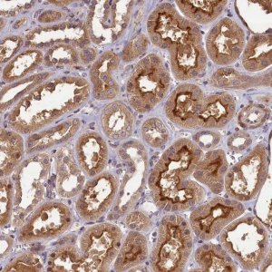 Anti-NUDT6 antibody produced in rabbit 