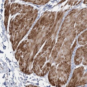 Anti-NUDT9 antibody produced in rabbit 