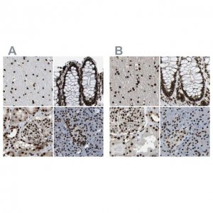 Anti-NUMA1 antibody produced in rabbit HPA019841-100UL
