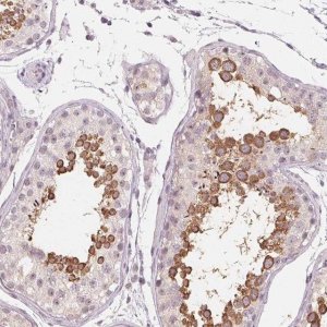 Anti-NUP210L antibody produced in rabbit 