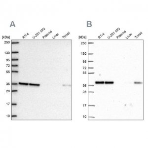 Anti-NUP37 antibody produced in rabbit HPA073708-100UL
