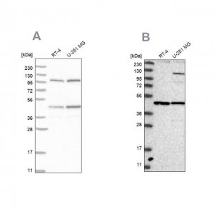 Anti-NUP43 antibody produced in rabbit 