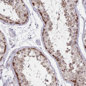 Anti-NUP85 antibody produced in rabbit 