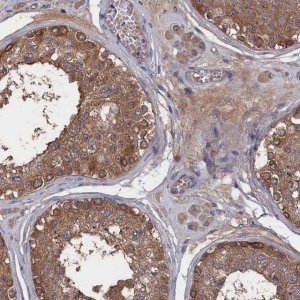 Anti-NUTF2 antibody produced in rabbit 