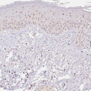 Anti-NVL antibody produced in rabbit HPA028224-100UL