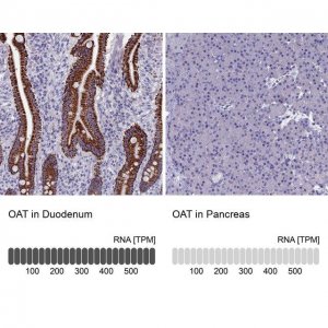 Anti-OAT antibody produced in rabbit 