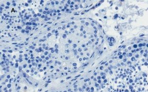 Anti-OCT4 Antibody, clone 4N8, ZooMAb Rabbit Monoclonal 