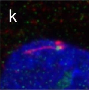 Anti-ODF2 antibody produced in rabbit 
