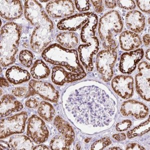 Anti-OGDHL antibody produced in rabbit 