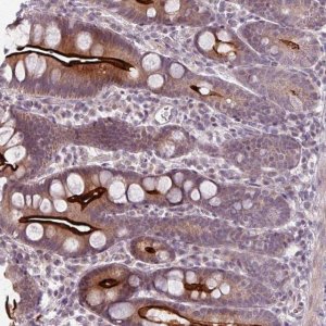 Anti-OGFOD3 antibody produced in rabbit 