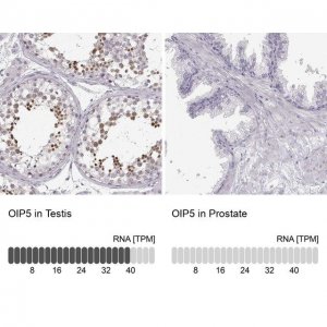 Anti-OIP5 antibody produced in rabbit HPA059602-100UL